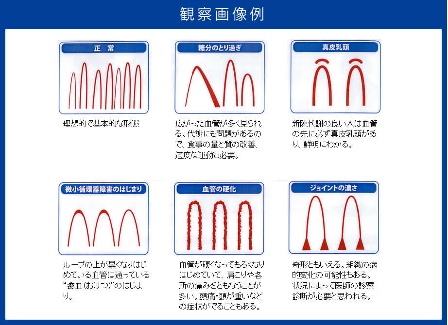 観察画像例